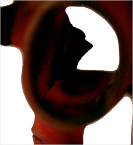 forme_fruste_07